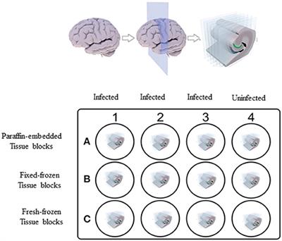 Detecting Borrelia Spirochetes: A Case Study With Validation Among Autopsy Specimens